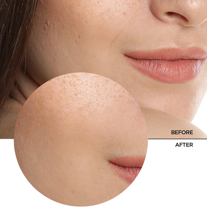 REVOX B77 Увлажняющая гелевая сыворотка для лица JUST HYALURONIC ACID 5%, 30 мл