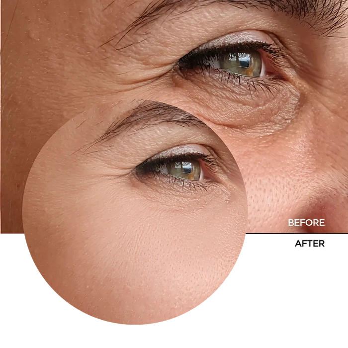 REVOX B77 Флюид для лица JUST RETINAL 0.2%, 30 мл