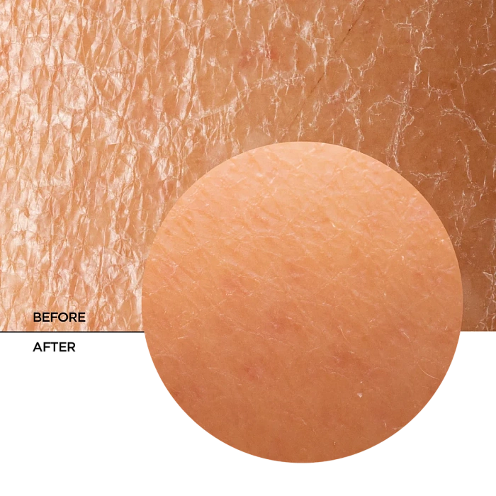 REVOX B77 Восстанавливающий заполняющий крем-бальзам с пробиотиками SKINTREATS BIOTIC, 50 мл