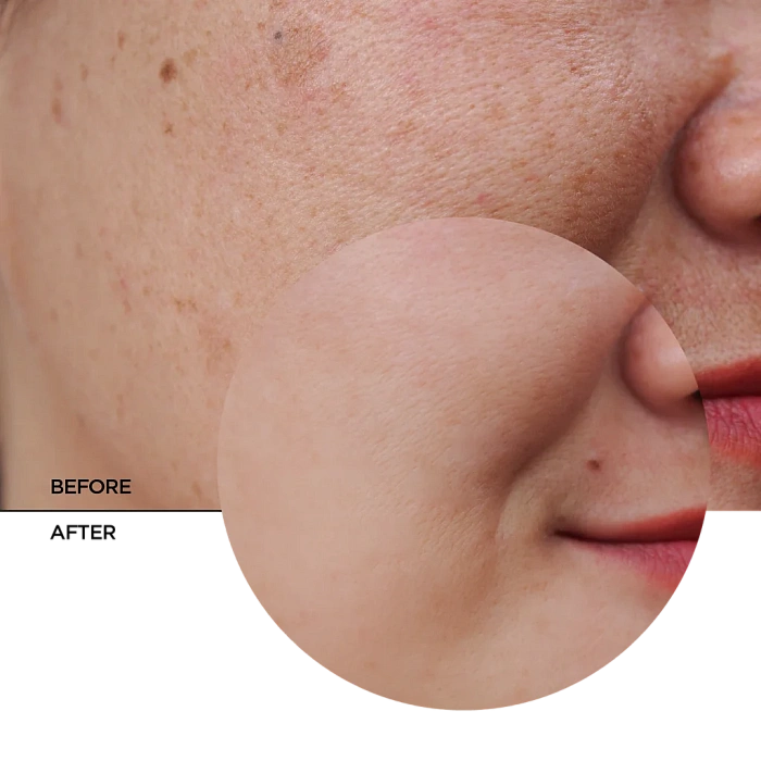 REVOX B77 Крем для лица с пробиотиками, восстанавливающий сияние SKINTREATS BIOTIC, 50 мл
