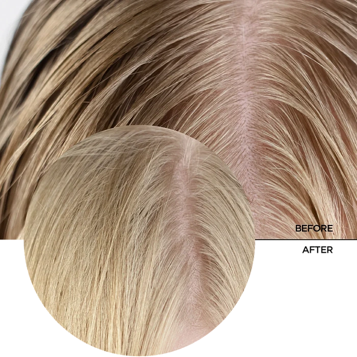 REVOX B77 Очищающая сыворотка для кожи головы JUST SALICYLIC ACID, 30 мл