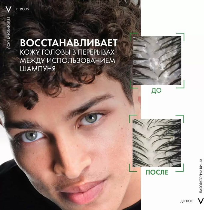 VICHY Dercos Technique Интенсивная сыворотка для кожи головы против перхоти Serum 10  90 мл