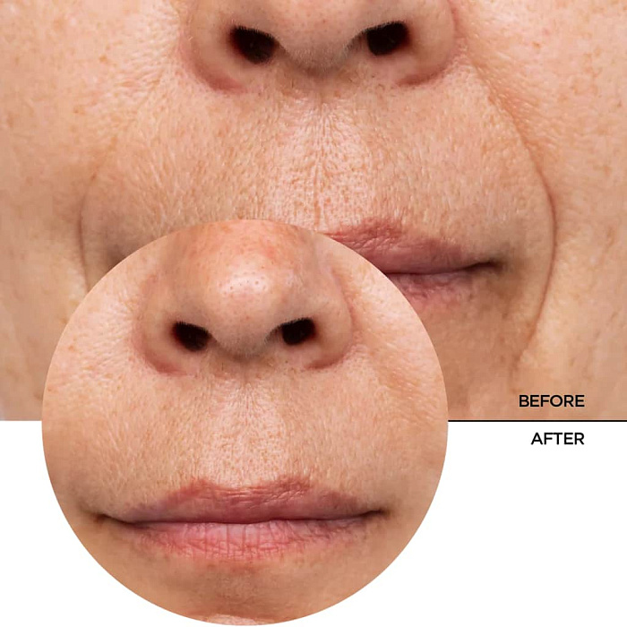 REVOX B77 Антивозрастная безводная сыворотка для лица JUST RETINOL IN SQUALANE H20-FREE, 30мл
