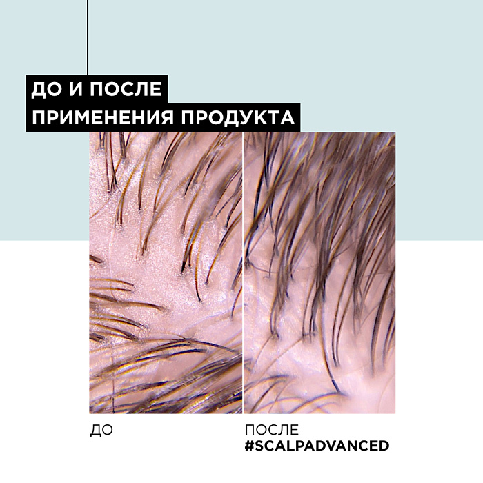L'Oreal Professionnel Шампунь-маска 2-в-1 глубоко очищающий для кожи головы склонной к жирности «Scalp Advanced» гаммы «Serie Expert»,250 мл