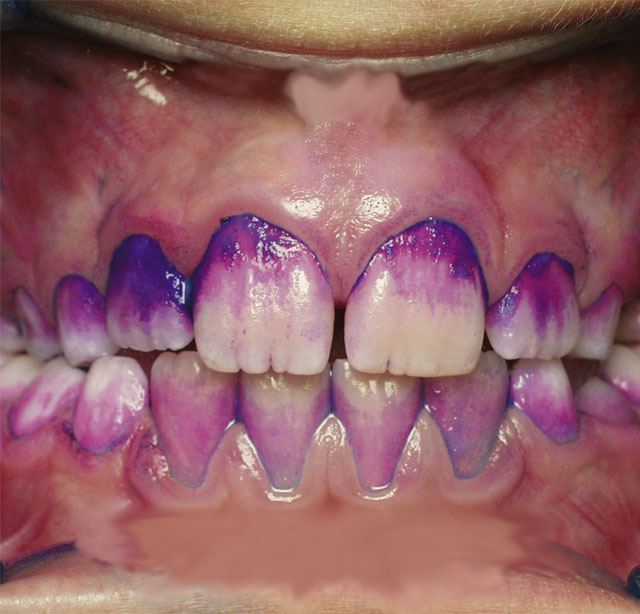 Curaprox Средство для индикации зубного налета (в таблетках), 12 шт