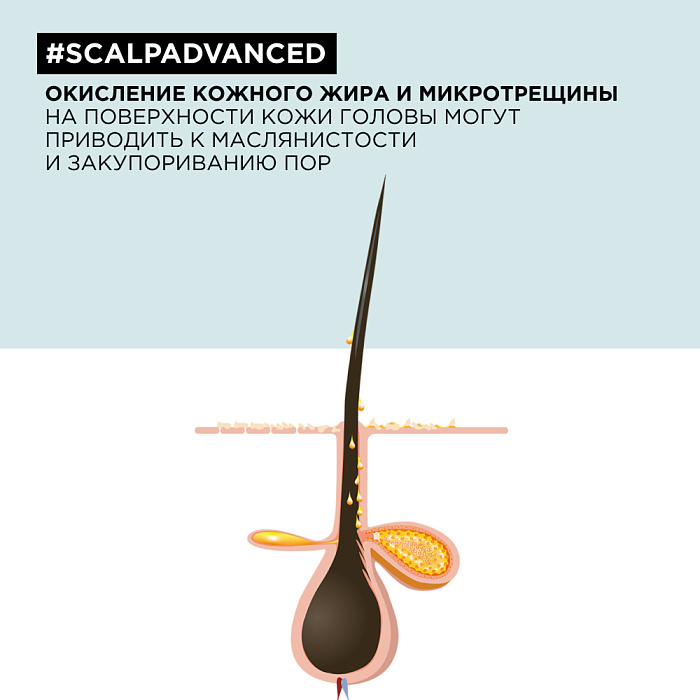 L'Oreal Professionnel Шампунь-маска 2-в-1 глубоко очищающий для кожи головы склонной к жирности «Scalp Advanced» гаммы «Serie Expert»,250 мл