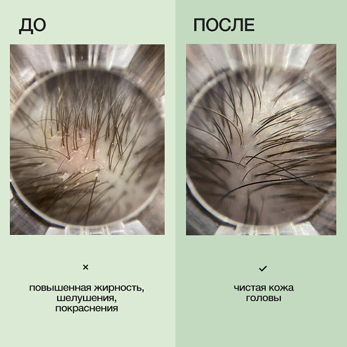 Limba Cosmetics Детокс-шампунь Detox Oily Hair Cleansing Shampoo, 300 мл