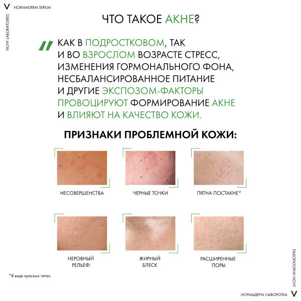 VICHY NORMADERM Сыворотка обновляющая, пробиотическая против несовершенств кожи (PROBIO-BHA SERUM), 30мл